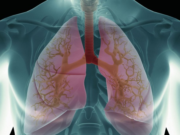 Foto - Naneyi böyle yerseniz anında kesiyor!