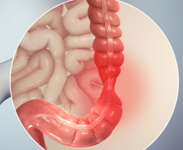 Foto - Naneyi böyle yerseniz anında kesiyor!