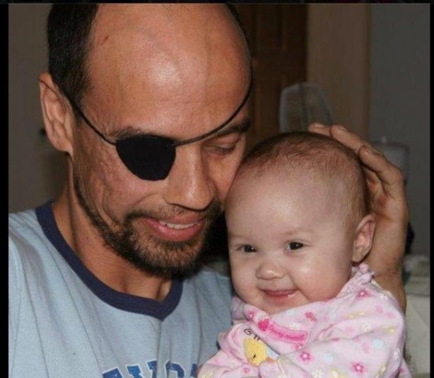 Foto - Nasıl hayatta kaldıklarına inanamayacaksınız!