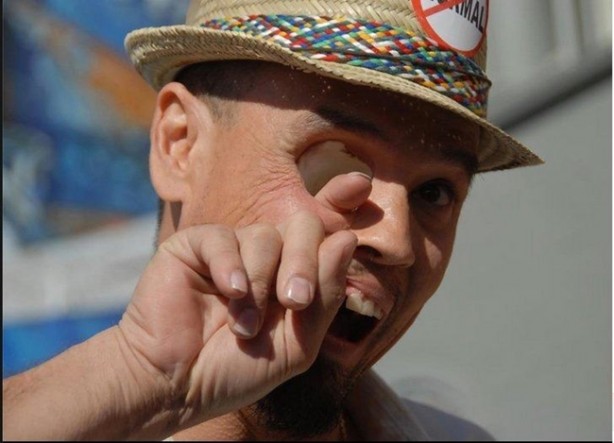 Foto - Nasıl hayatta kaldıklarına inanamayacaksınız!