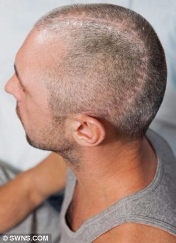 Foto - Nasıl hayatta kaldıklarına inanamayacaksınız!