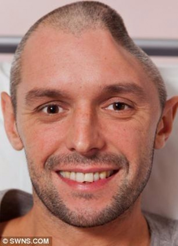 Foto - Nasıl hayatta kaldıklarına inanamayacaksınız!