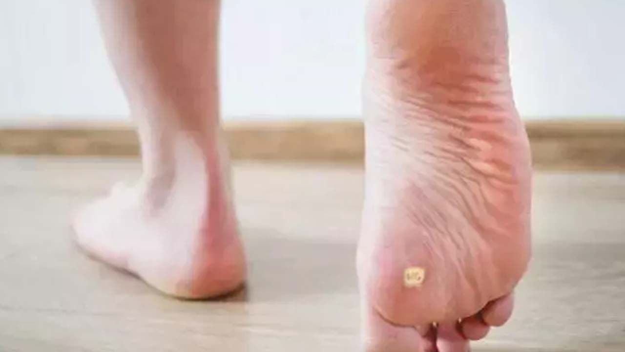 Foto - Nasır, mantar ve egzamanın kökünü kurutuyor! 