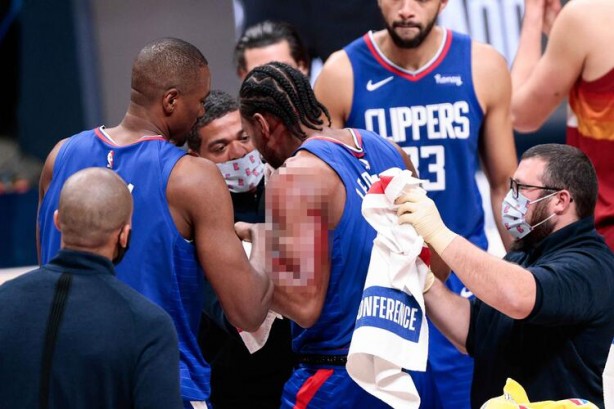 Foto - NBA'de korku dolu anlar! Kahwi Leonard kanlar içinde yere yığıldı