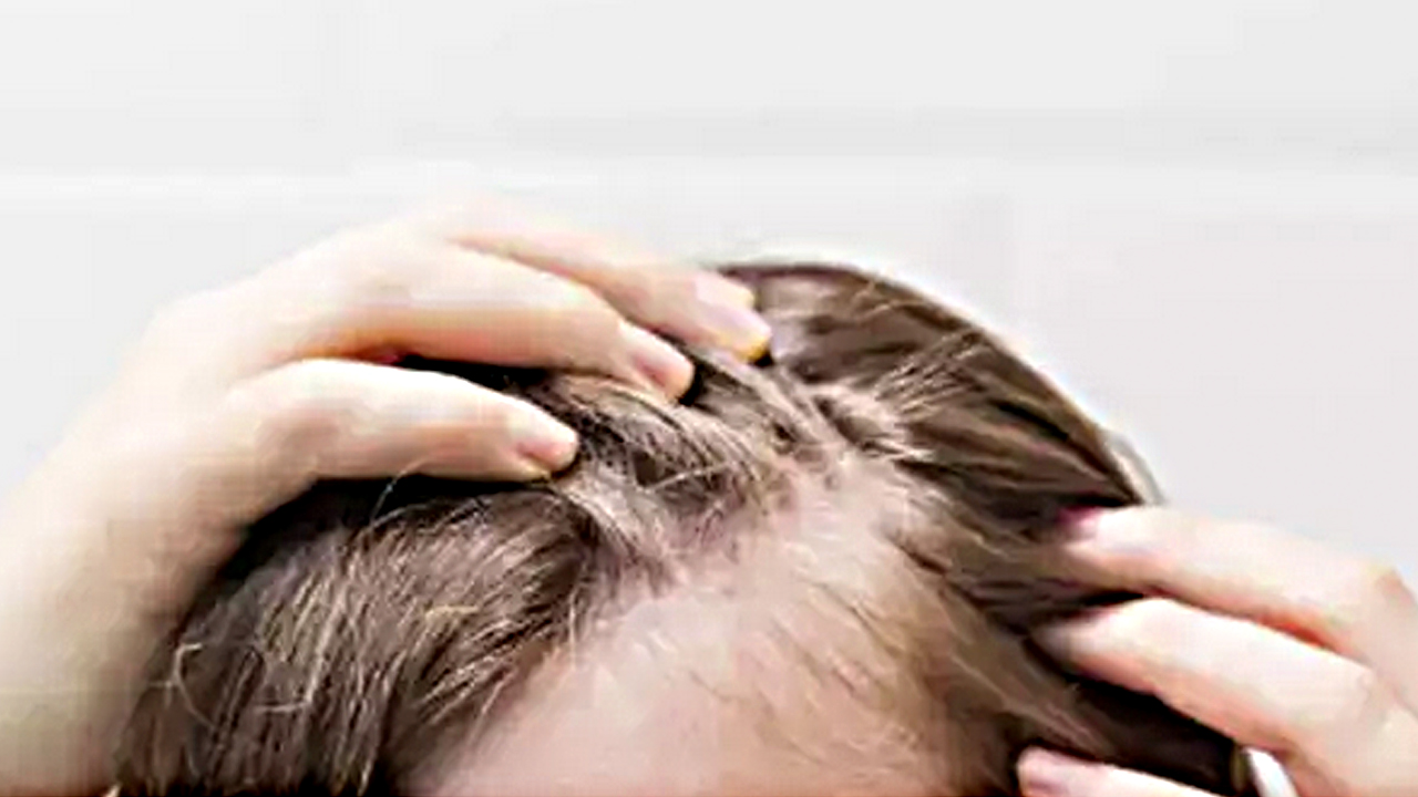 Foto - Ne biberiye ne argan, tel tel dökülen saç dökülmesini durduran tüyo 6 haftada uzatacak