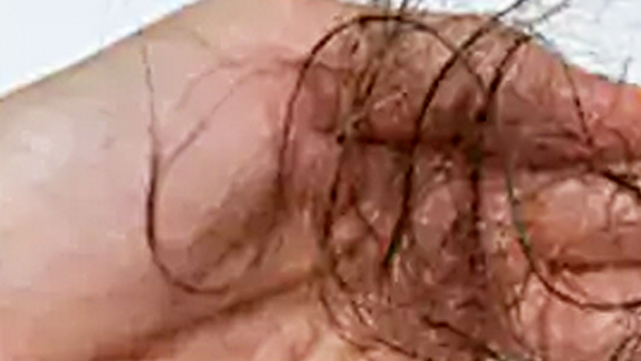 Ne biberiye ne argan, tel tel dökülen saç dökülmesini durduran tüyo 6 haftada uzatacak