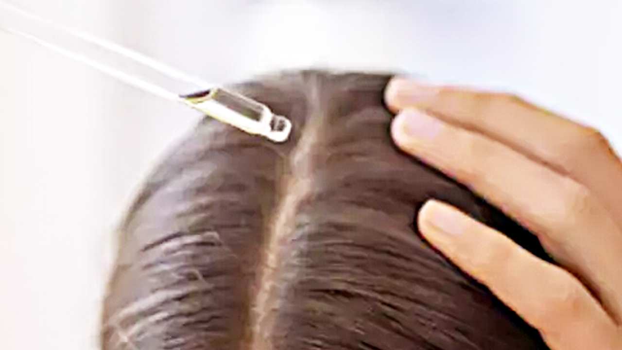 Foto - Ne biberiye ne argan, tel tel dökülen saç dökülmesini durduran tüyo 6 haftada uzatacak