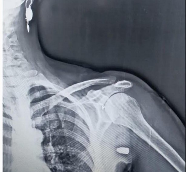 Foto - Ne yapsan fayda etmiyor! Trabzon'un baş belası