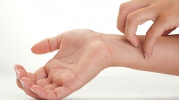 Foto - Neden kaşınırız?