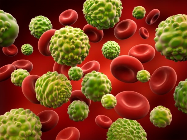 Foto - Nedenini bilmediğiniz yorgunluğunuz varsa, dikkat!