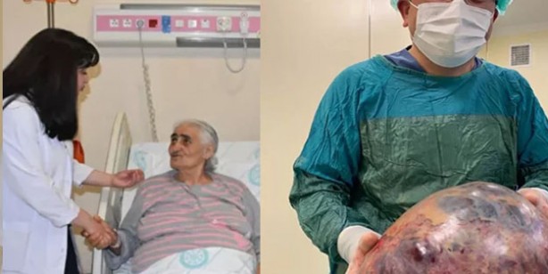 Foto - Nefes darlığı şikayetiyle hastaneye giden kadının karnından öyle bir şey çıktı ki!