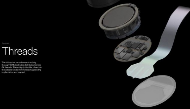 Foto - Neuralink ikinci hastaya çip yerleştirdi