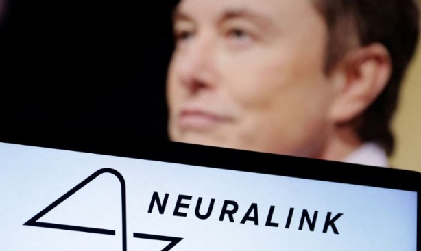 Foto - Neuralink ikinci hastaya çip yerleştirdi