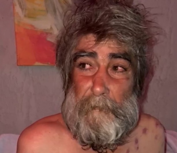 Foto - Neydi ne oldu! Sokakta kalan vatandaşın inanılmaz değişimi