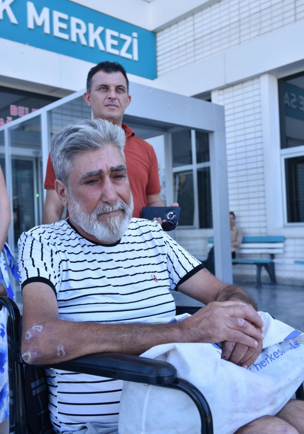 Foto - Neydi ne oldu! Sokakta kalan vatandaşın inanılmaz değişimi