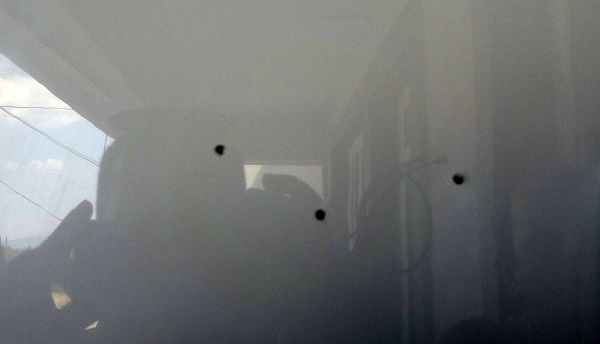 Foto - Neye uğradığını şaşırdı! Yaşlı adamın kaşına saçma isabet etti