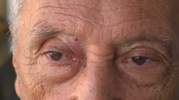 Foto - Neye uğradığını şaşırdı! Yaşlı adamın kaşına saçma isabet etti