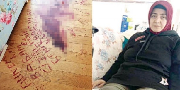 Foto - Nurtaç Canan'ın şiddet gördüğü eşi Ragıp Canan yakalandı mı?