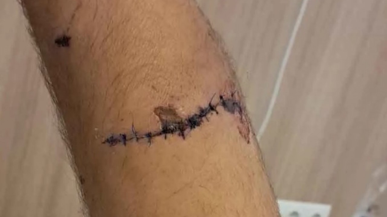 Foto - O ilimizde ayı dehşet saçtı! Peşinden gelip yakaladı sonra bakın ne yaptı