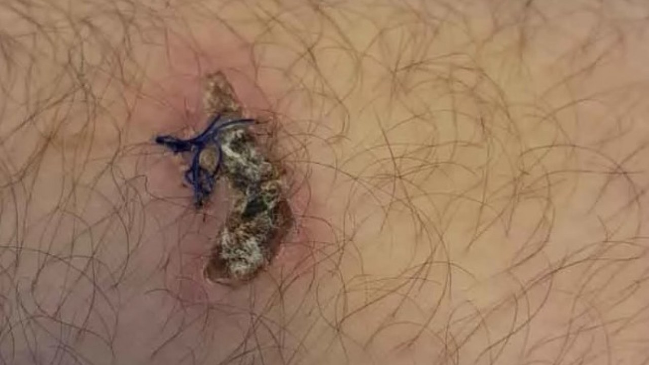 Foto - O ilimizde ayı dehşet saçtı! Peşinden gelip yakaladı sonra bakın ne yaptı