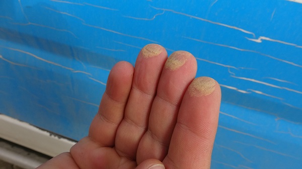 Foto - O ilimizde gökten çamur yağdı! 