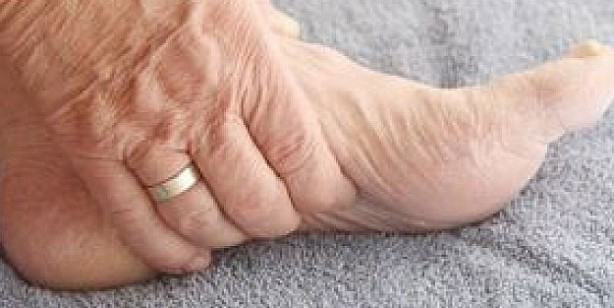 Foto - Ödeme iyi gelen 10 besin