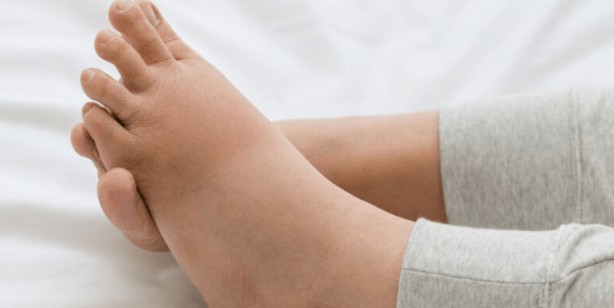 Foto - Ödeme iyi gelen 10 besin