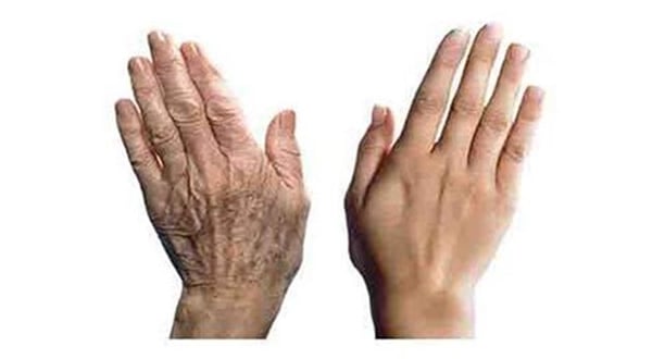 Foto - Gerçek yaşınızı merak ediyor musunuz? Gelin hesaplayalım!