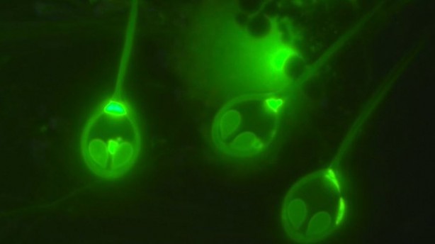 Foto - Oksijene ihtiyaç duymadan hayatta kalabilen canlı keşfedildi