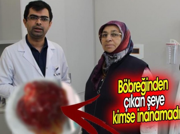 Öksürük şikayetiyle gitti, hayatının şokunu yaşadı! Böbreğinden çıkan şeye kimse inanamadı