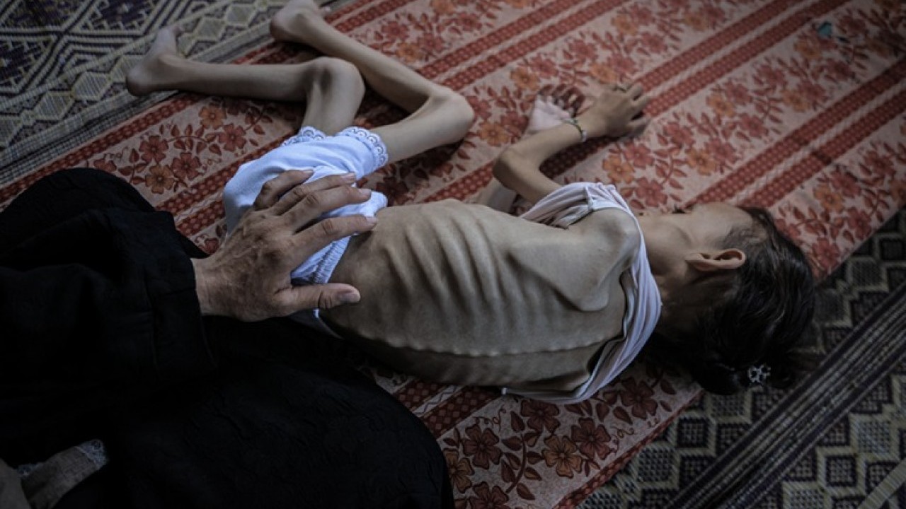 Foto - Okudukça kanınız çekilecek! İnsanlıktan utandıran haber