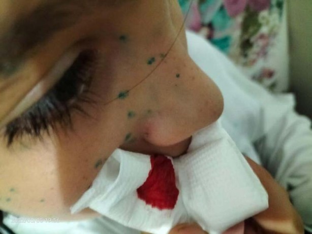 Foto - Okulda dehşete düşüren olay! 5'inci sınıf öğrencisi ölümden döndü