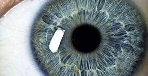 Ölümcül hastalık gözlerden ortaya çıkıyor
