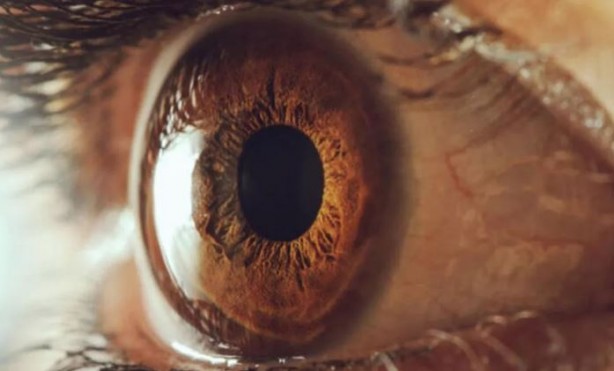 Foto - Ölümcül hastalık gözlerden ortaya çıkıyor