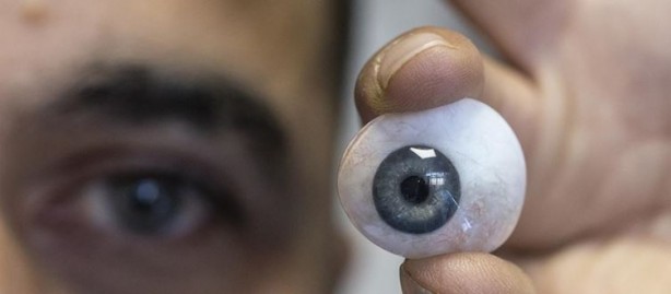 Foto - Ölümcül hastalık gözlerden ortaya çıkıyor