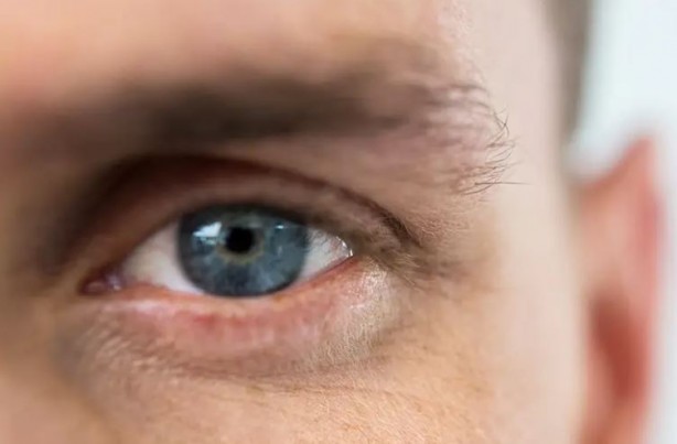 Foto - Ölümcül hastalık gözlerden ortaya çıkıyor