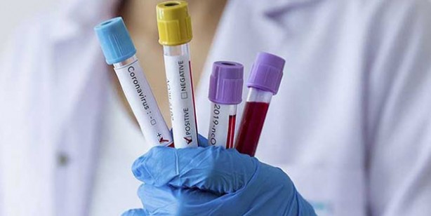 Foto - Ölümcül virüse karşı zafer kazandı derken… Gizli belgeler ortaya çıktı