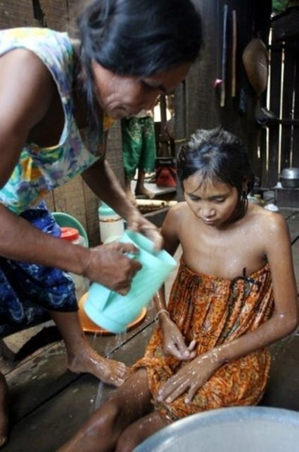 Foto - Onların yaşam hikayeleri inanılmaz