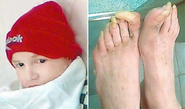 Foto - Onların yaşam hikayeleri inanılmaz