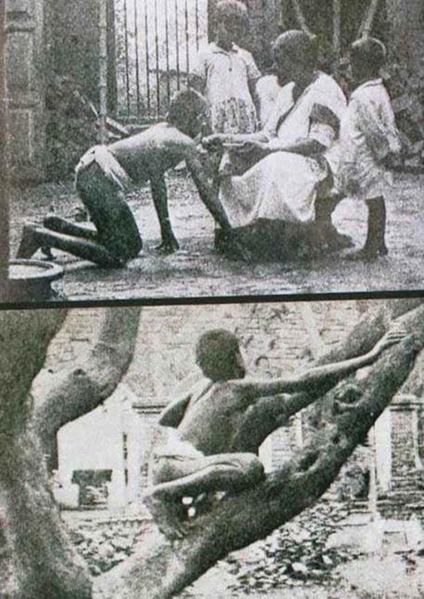 Foto - Onların yaşam hikayeleri inanılmaz