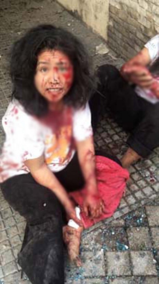 Foto - Ortalık toz duman! Lübnan'daki saldırının arkasından bakın kim çıktı