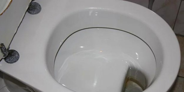 Foto - Oruçluyken makata krem sürmek orucu bozar mı?