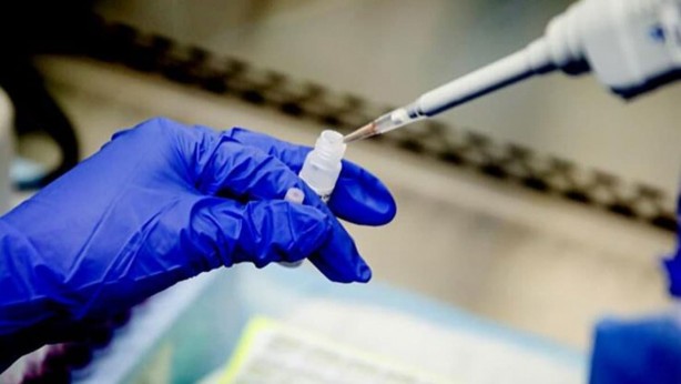 Foto - Oxford Üniversitesi duyurdu! Koronavirüste yeni gelişme