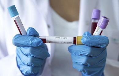 Foto - Oxford Üniversitesi’den dünyayı ayağa kaldıran açıklama! Aşı için zaman verildi, 500’den fazla gönüllü olacak