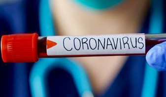 Foto - Oxford Üniversitesi’den dünyayı ayağa kaldıran açıklama! Aşı için zaman verildi, 500’den fazla gönüllü olacak