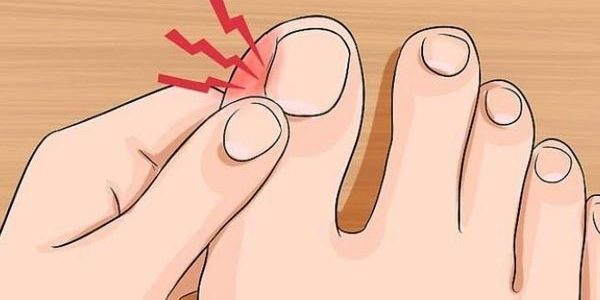 Foto - Pamuk işi çözüyor! Tırnak batmasına karşı sır gibi saklanan çözümler!