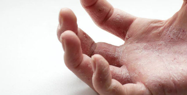 Foto - Para girecek çıkacakla alakası yok! İşte avuç içi kaşıntısının nedenleri