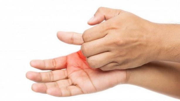 Foto - Para girecek çıkacakla alakası yok! İşte avuç içi kaşıntısının nedenleri