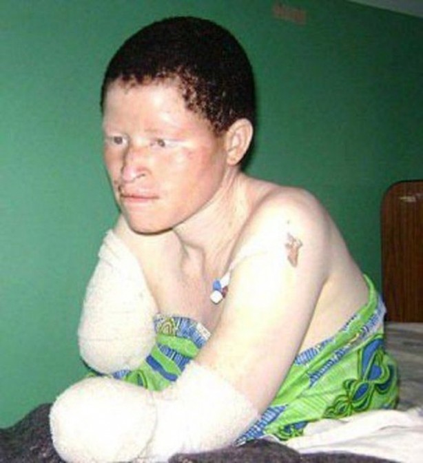 Foto - Parçalayıp satıyorlar...