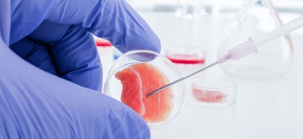 Foto - Parkinson hastalığı için umut doğdu